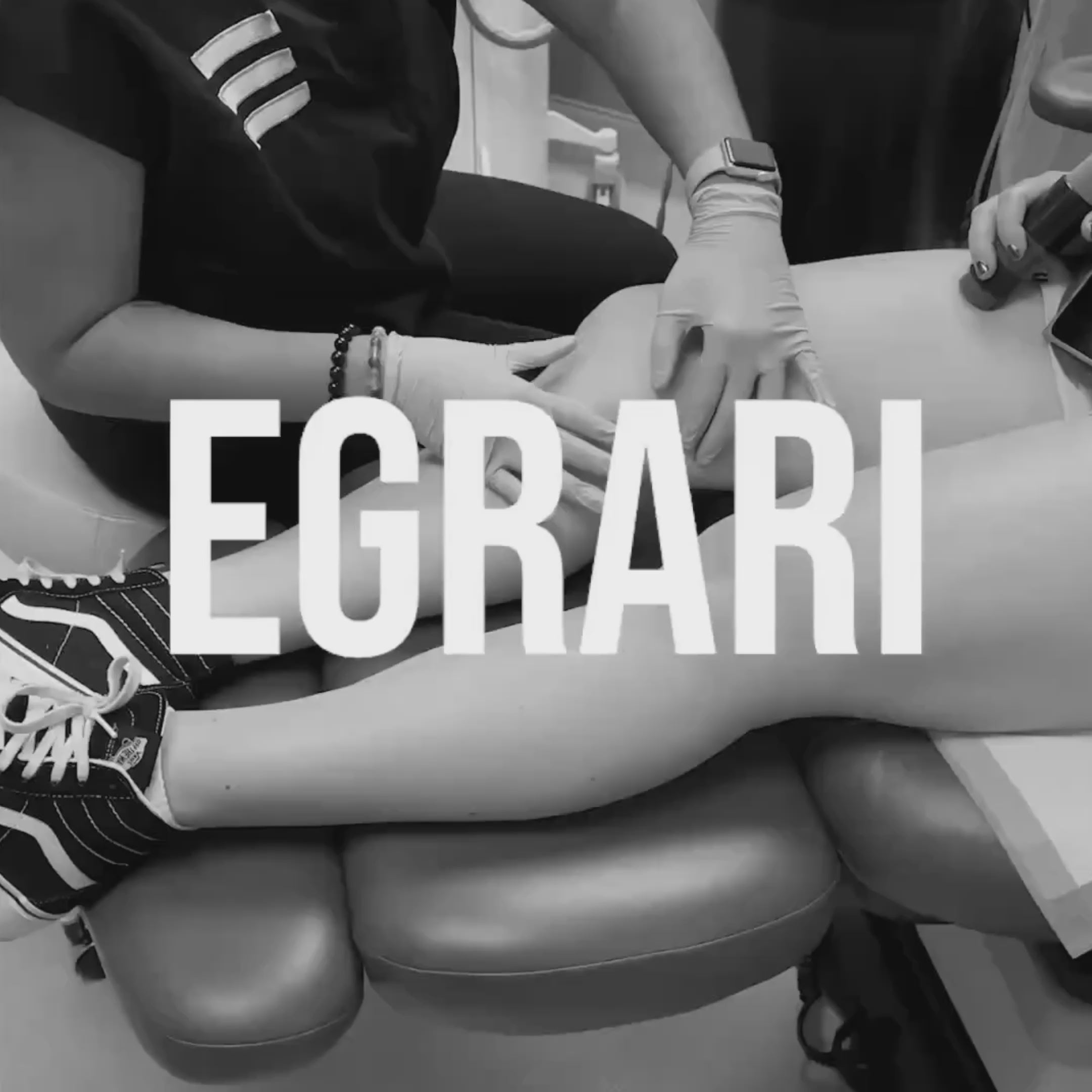 video of morpheus8 body treatment to tight skin of the knees