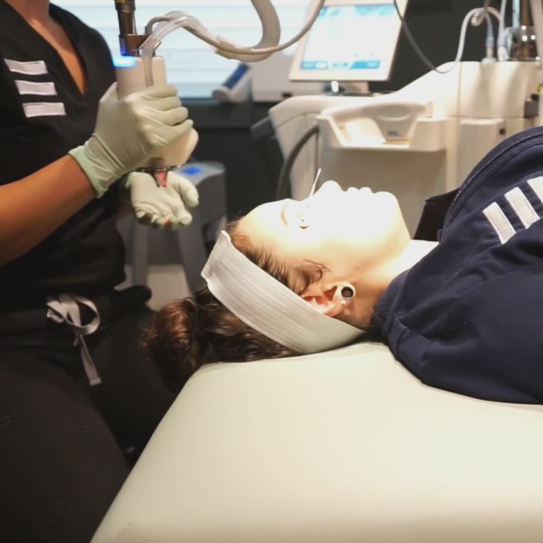 woman getting halo laser treatment on face for skin texture and wrinkles
